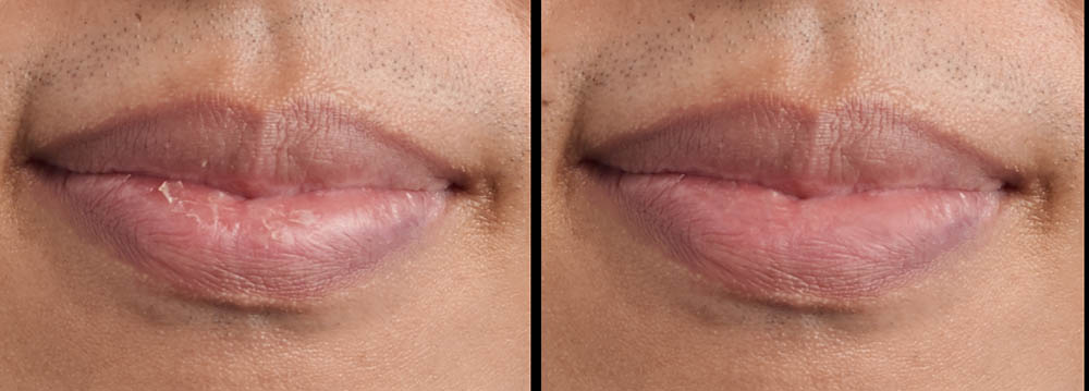 retouch chapped lips